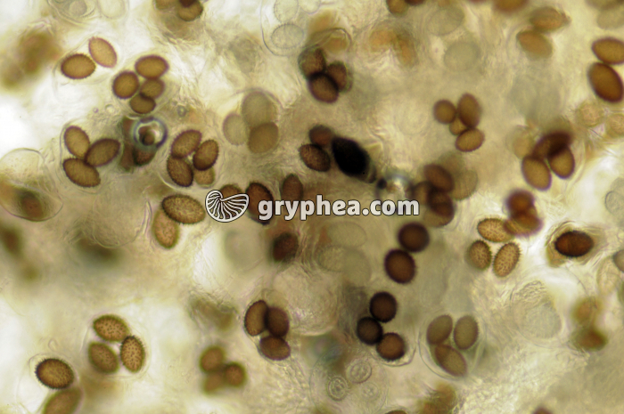 Spores de Truffe (Tuber melanosporum) x40 - gryphea.com